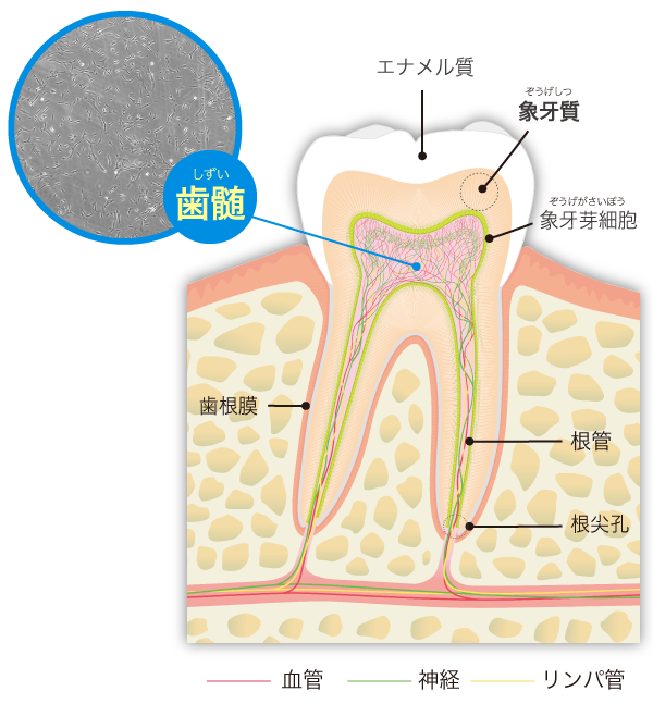歯髄再生治療