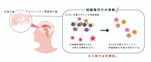 歯髄幹細胞の分泌物が神経を保護―アルツハイマー病の進行抑制に期待―