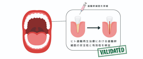 ヒトの歯髄は再生できるか？歯髄幹細胞を使った世界初の臨床研究
