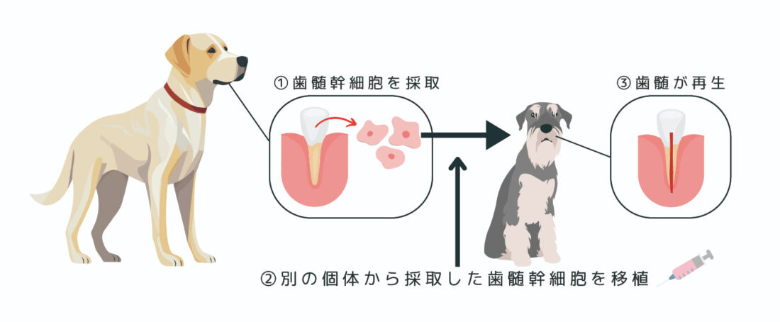 他人の歯髄幹細胞でも安全？歯髄再生における他家移植の可能性