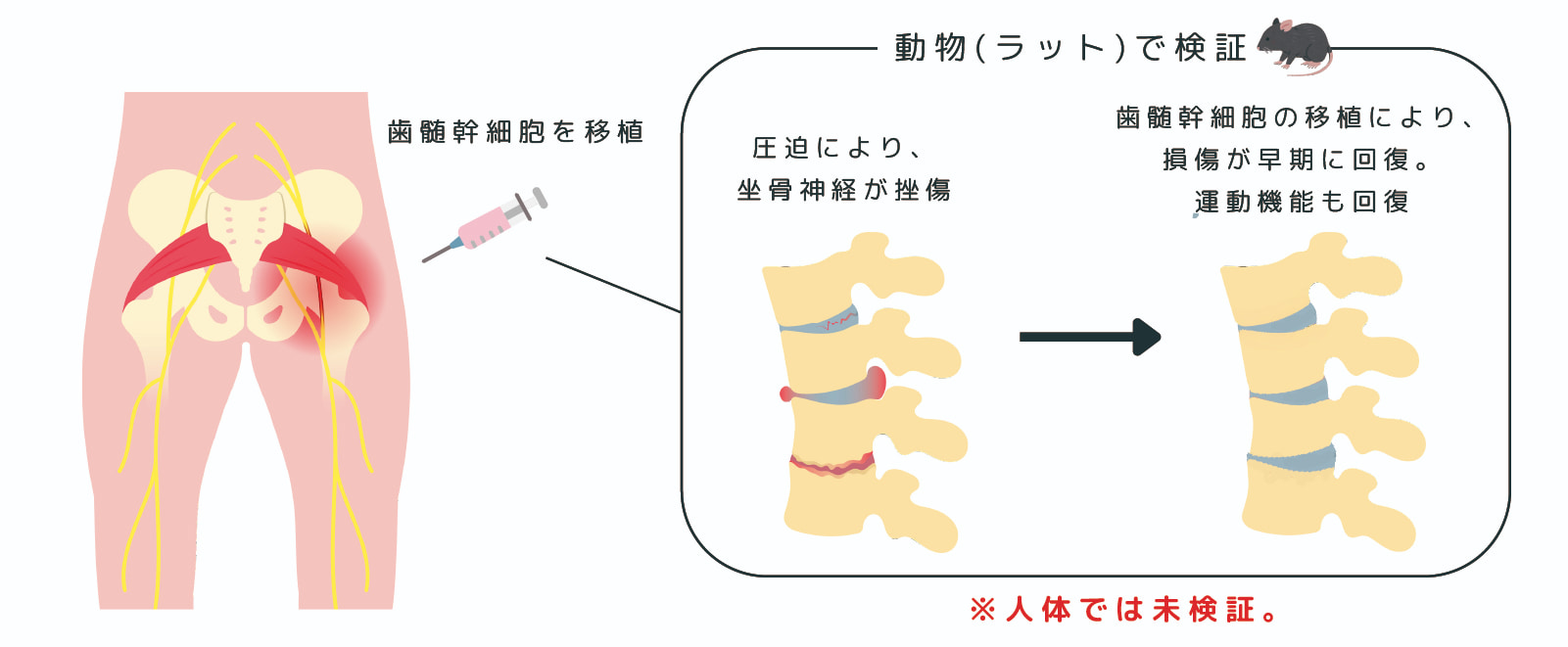 歯髄幹細胞が坐骨神経挫傷の回復を早める？坐骨神経挫傷に対する回復
