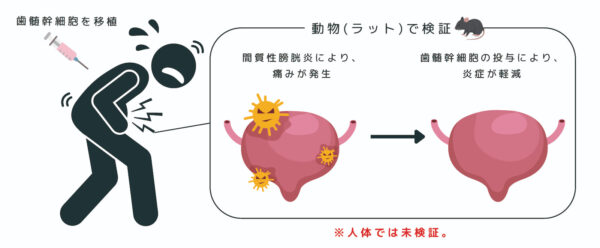 歯髄幹細胞が膀胱の痛みをやわらげる？間質性膀胱炎モデルでの再生医療の可能性