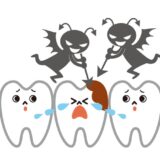 前歯の虫歯の原因は？治療法や予防法をわかりやすく解説します